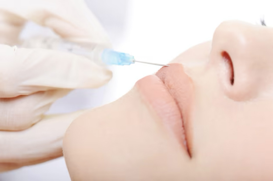 lip-fillers-1