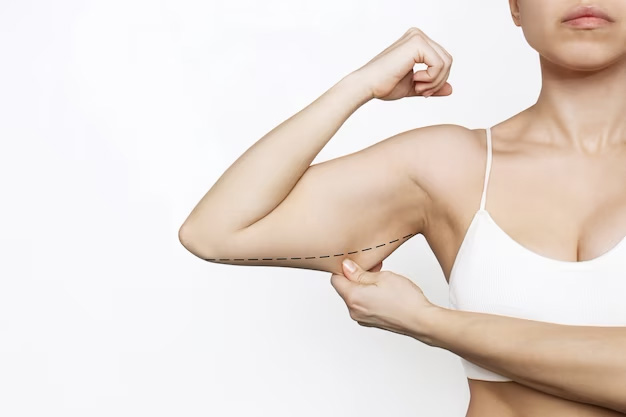 arm-lift